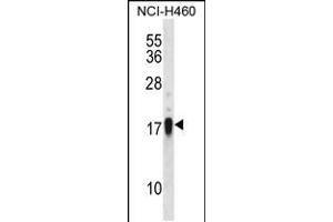 Image no. 1 for anti-CD70 Molecule (CD70) (AA 72-101) antibody (ABIN5535986)