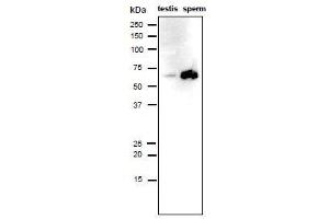 Image no. 5 for anti-Izumo Sperm-Egg Fusion 1 (IZUMO1) antibody (ABIN2452040)