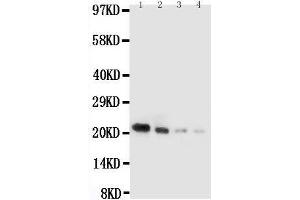 Image no. 1 for anti-Interleukin 18 (IL18) (AA 36-192) antibody (ABIN3042801)