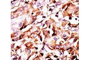 Image no. 1 for anti-BCL2-Associated Agonist of Cell Death (BAD) (pSer99) antibody (ABIN3030130)