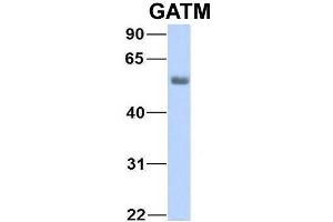 Image no. 5 for anti-Glycine Amidinotransferase (L-Arginine:glycine Amidinotransferase) (GATM) (Middle Region) antibody (ABIN2783416)