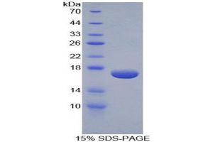 Image no. 1 for Epsin 1 (EPN1) (AA 279-437) protein (His tag) (ABIN1879223)
