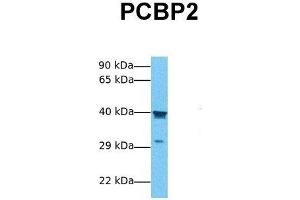 Image no. 4 for anti-Poly(rC) Binding Protein 2 (PCBP2) (Middle Region) antibody (ABIN2778923)