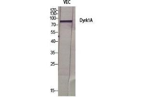 Image no. 2 for anti-Dual-Specificity tyrosine-(Y)-phosphorylation Regulated Kinase 1A (DYRK1A) (N-Term) antibody (ABIN3184371)