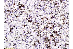 Image no. 3 for anti-Microphthalmia-Associated Transcription Factor (MITF) antibody (ABIN676373)