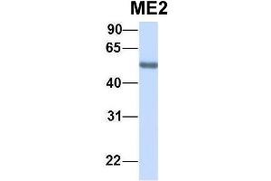 Image no. 2 for anti-NAD Dependent Malate Dehydrogenase (NAD-ME) (N-Term) antibody (ABIN2784265)