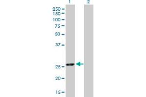 Image no. 1 for anti-Exosome Component 5 (EXOSC5) (AA 1-235) antibody (ABIN528001)