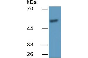 Image no. 4 for Matrix Metallopeptidase 11 (Stromelysin 3) (MMP11) ELISA Kit (ABIN6574149)