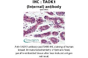 Image no. 1 for anti-TAO Kinase 1 (TAOK1) (Internal Region) antibody (ABIN1739900)