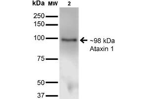Image no. 2 for anti-Ataxin 1 (ATXN1) (AA 746-761) antibody (ABIN1741521)