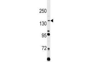 Image no. 1 for anti-L1 Cell Adhesion Molecule (L1CAM) (AA 1154-1182) antibody (ABIN3031578)
