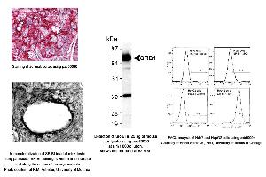 Image no. 3 for anti-Scavenger Receptor Class B, Member 1 (SCARB1) (AA 450-509), (C-Term) antibody (ABIN363399)