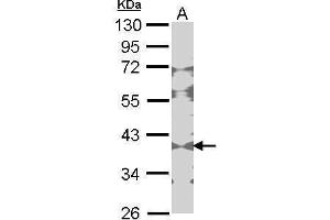 Image no. 2 for anti-Creatine Kinase, Brain (CKB) (Center) antibody (ABIN2855157)
