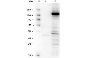 Image no. 5 for anti-Telomerase Reverse Transcriptase (TERT) (C-Term) antibody (ABIN6655270)