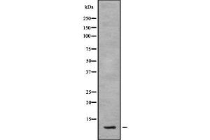Image no. 1 for anti-Small Nuclear RNA Activating Complex, Polypeptide 5, 19kDa (SNAPC5) antibody (ABIN6265205)