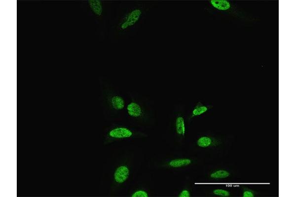 PRRX2 antibody  (AA 1-253)
