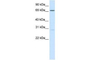 Image no. 1 for anti-Nuclear Factor of Activated T-Cells 5, Tonicity-Responsive (NFAT5) (Middle Region) antibody (ABIN927663)