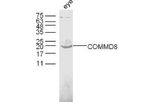 Image no. 1 for anti-COMM Domain Containing 8 (COMMD8) (AA 101-183) antibody (ABIN872529)