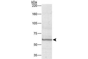 Image no. 1 for anti-Bestrophin 1 (BEST1) antibody (ABIN534053)