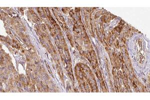 Image no. 1 for anti-CTD (Carboxy-Terminal Domain, RNA Polymerase II, Polypeptide A) Small Phosphatase Like 2 (CTDSPL2) (pSer104) antibody (ABIN6256089)