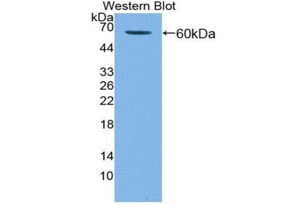 KIR2DL3 Antikörper  (AA 22-342)