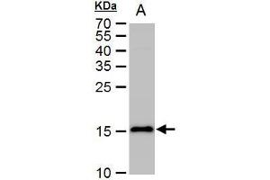 Image no. 3 for anti-Microtubule-Associated Protein 1 Light Chain 3 beta (MAP1LC3B) (full length) antibody (ABIN2854667)