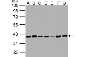 Image no. 2 for anti-Protein Phosphatase 1, Catalytic Subunit, beta Isoform (PPP1CB) (Center) antibody (ABIN2856078)