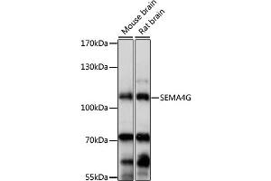 Image no. 1 for anti-Semaphorin 4G (SEMA4G) antibody (ABIN6293677)