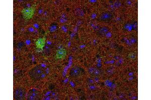 Image no. 2 for anti-Synaptic Vesicle Glycoprotein 2B (SV2B) (AA 2-17) antibody (ABIN1742258)
