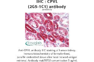Image no. 1 for anti-Carboxypeptidase, Vitellogenic-Like (CPVL) (AA 1-477), (full length) antibody (ABIN1723589)