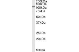 Image no. 2 for anti-Serine/threonine-Protein Phosphatase 4 Regulatory Subunit 3A (SMEK1) (Internal Region) antibody (ABIN334493)