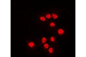 Image no. 1 for anti-Activating Transcription Factor 7 (AFT7) (Center) antibody (ABIN2705531)