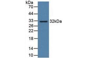 Image no. 4 for CD274 (PD-L1) ELISA Kit (ABIN6574208)