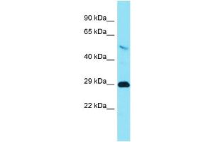TMEM65 Antikörper  (C-Term)