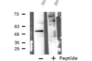 Image no. 1 for anti-Inositol Hexakisphosphate Kinase 3 (IP6K3) (Internal Region) antibody (ABIN6258488)