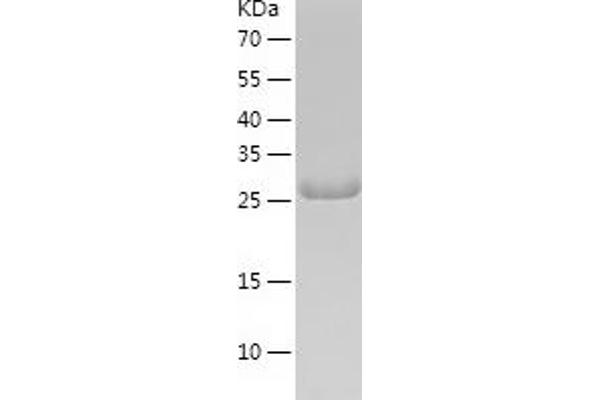 RPS4X Protein (AA 1-263) (His tag)