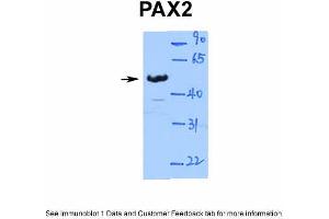 Image no. 1 for anti-Paired Box Gene 2a (PAX2A) (Middle Region) antibody (ABIN2792620)