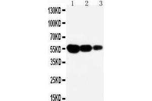 Image no. 3 for anti-TNF Receptor Superfamily, Member 6 (FAS) (AA 87-109), (N-Term) antibody (ABIN3044338)