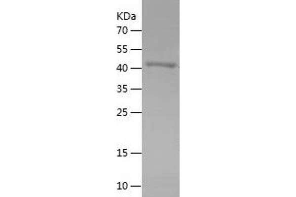 OSGIN1 Protein (AA 212-477) (His-IF2DI Tag)
