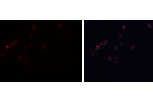Image no. 2 for anti-Perilipin 1 (PLIN1) antibody (ABIN6264141)