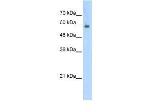 Image no. 1 for anti-Eukaryotic Translation Initiation Factor 4 gamma 3 (EIF4G3) (N-Term) antibody (ABIN2778867)