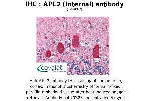 Image no. 1 for anti-APC Regulator of WNT Signaling Pathway 2 (APC2) (Internal Region) antibody (ABIN1731845)
