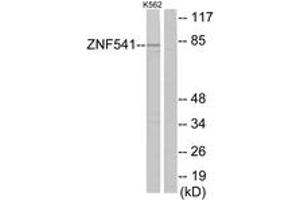 Image no. 1 for anti-Zinc Finger Protein 541 (ZNF541) (AA 931-980) antibody (ABIN1534115)