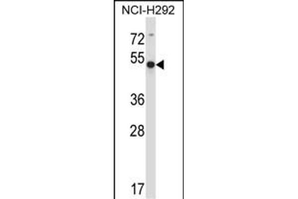 ACTR6 抗体  (C-Term)