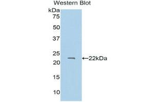 Image no. 1 for anti-Protein S (PROS) (AA 301-476) antibody (ABIN1175271)