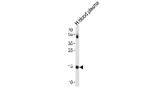 Image no. 3 for anti-Transthyretin (TTR) (C-Term) antibody (ABIN2498105)