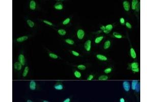 Immunofluorescence analysis of U2OS cells using PPAR gamma Polyclonal Antibody at dilution of 1:100.