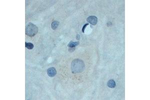 Image no. 5 for anti-Neurotrophic tyrosine Kinase, Receptor, Type 3 (NTRK3) (Extracellular Domain) antibody (ABIN351086)