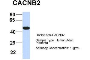 Image no. 3 for anti-Calcium Channel, Voltage-Dependent, beta 4 Subunit (CACNB4) (Middle Region) antibody (ABIN2774681)
