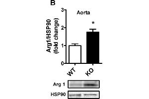 Image no. 7 for anti-Arginase, Liver (ARG1) (full length) antibody (ABIN2856661)
